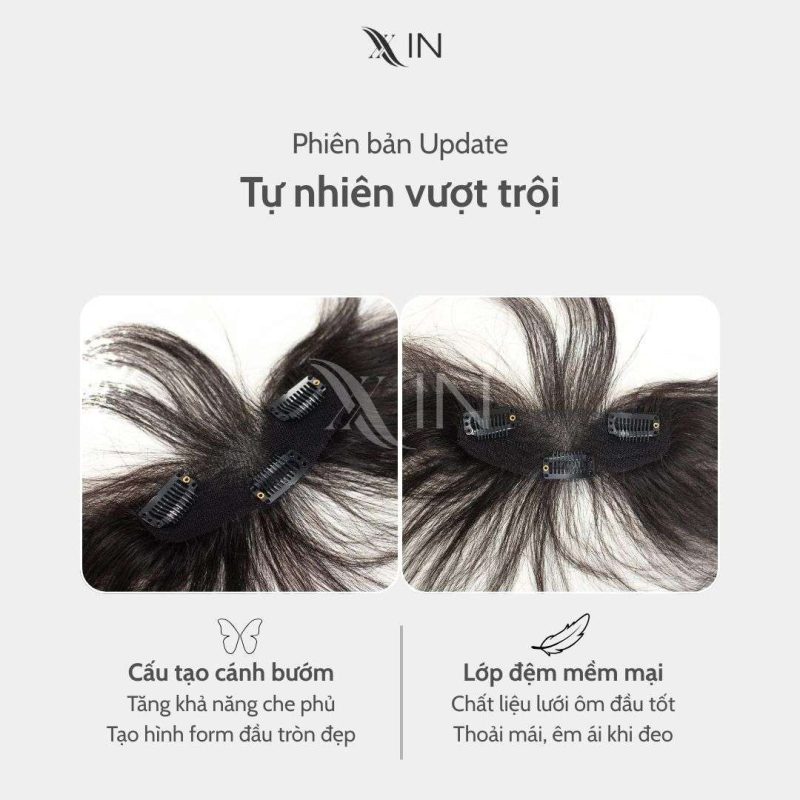 Phủ Hói Mái Chữ M tóc thật che hói vùng trán - Phủ mái 391